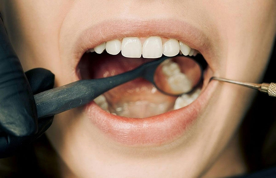 oral-hygiene-pexels-arvind-philomin-187831830-12148417 ओरल हाइजीन